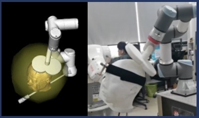 基于脑机接口的个体化经颅磁刺激系统